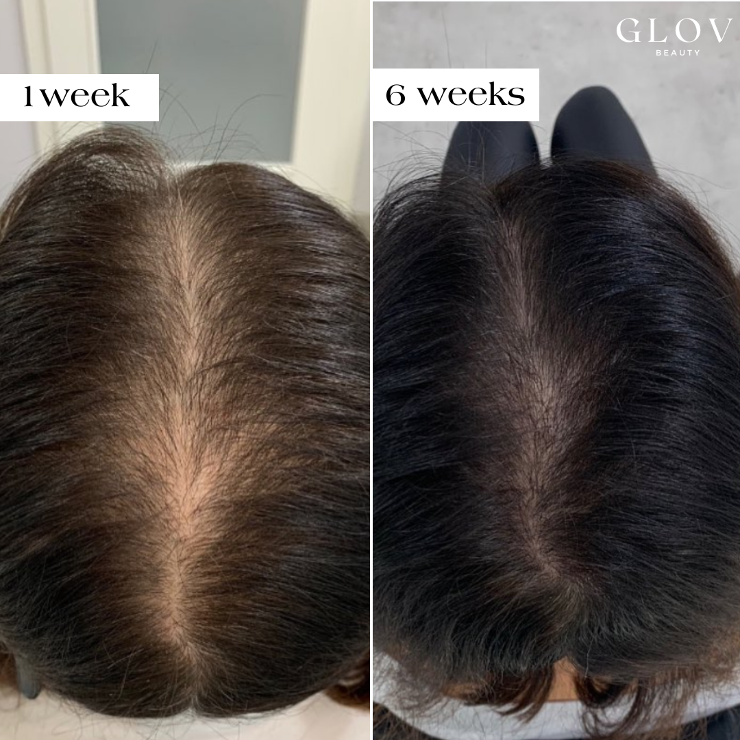 Before and after comparison of hair thickness with 'GLOV' branding.