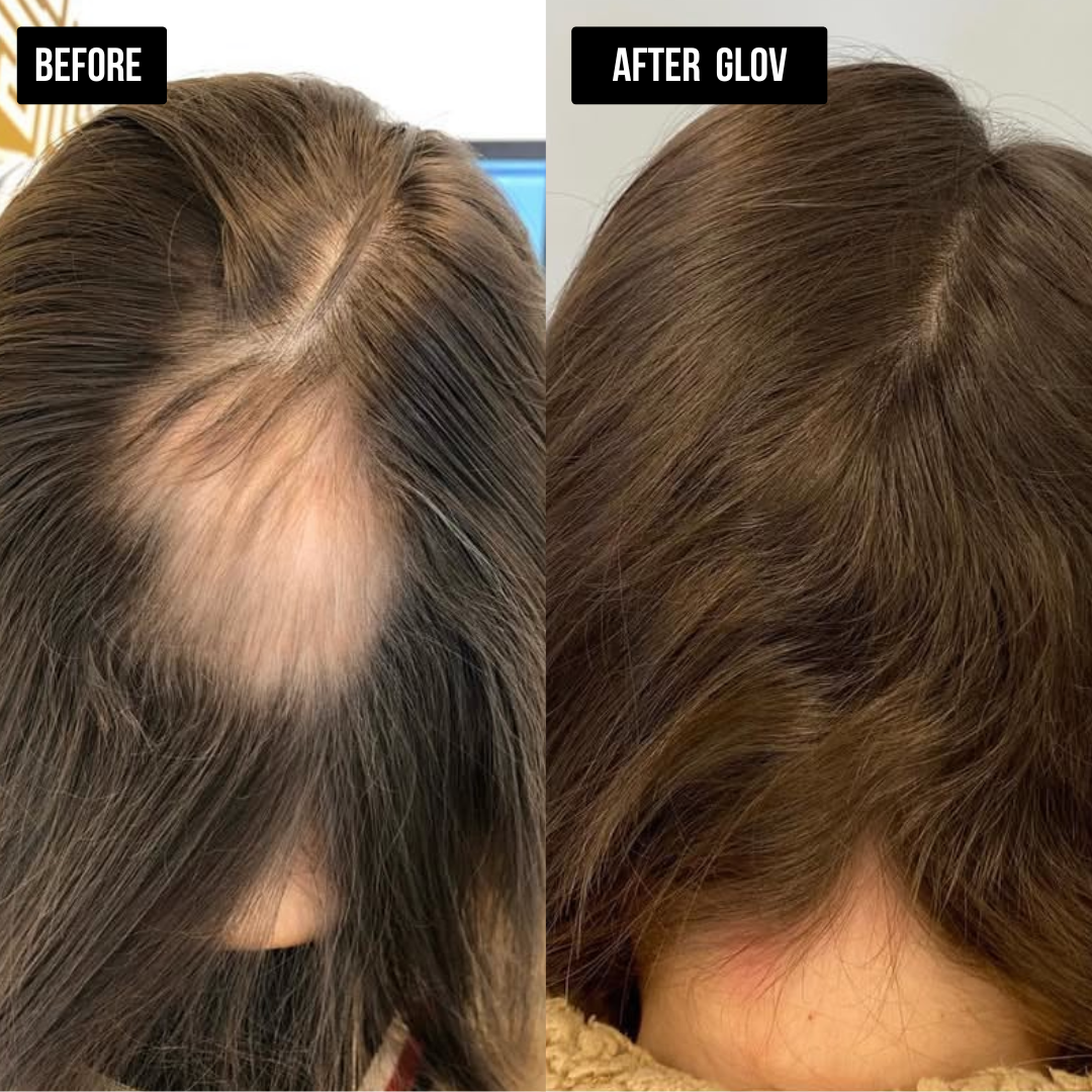 Nivah Hair Regrowth System