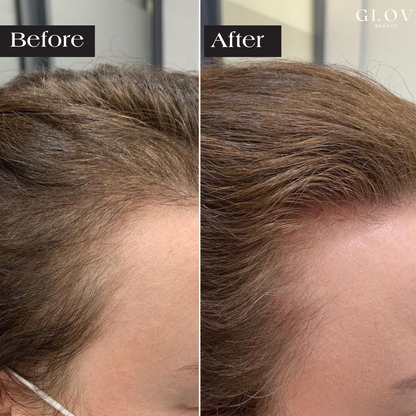Nivah Hair Regrowth System