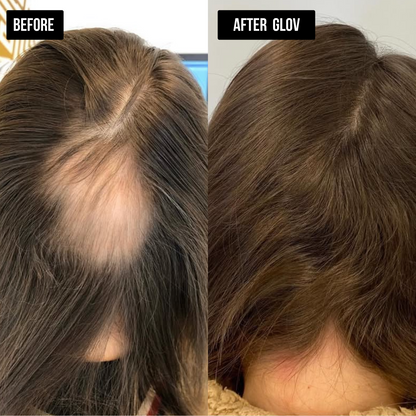 Nivah Hair Regrowth System