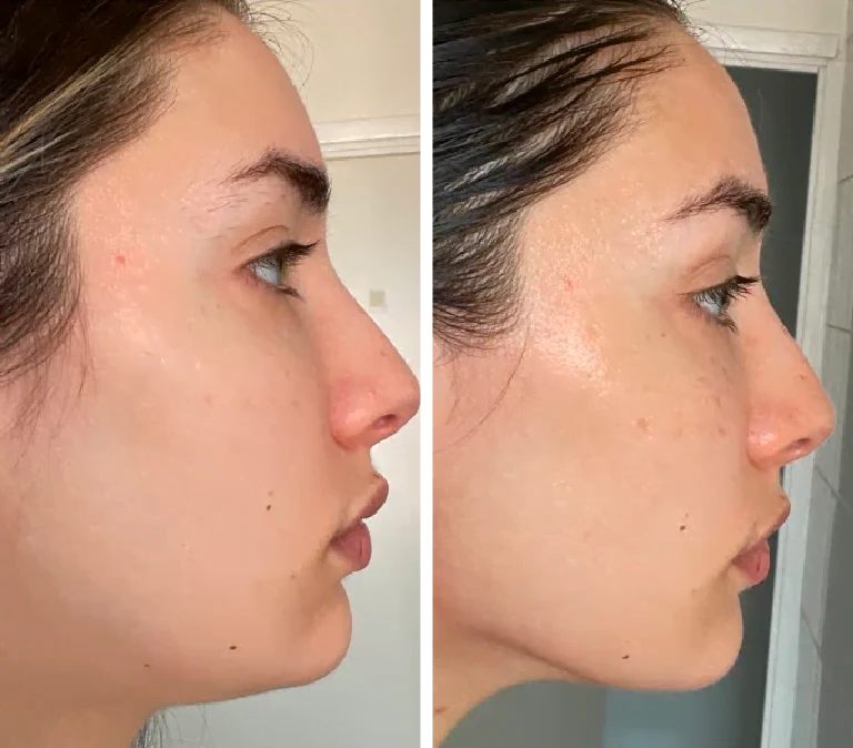 ContourFlow™ Face Brush